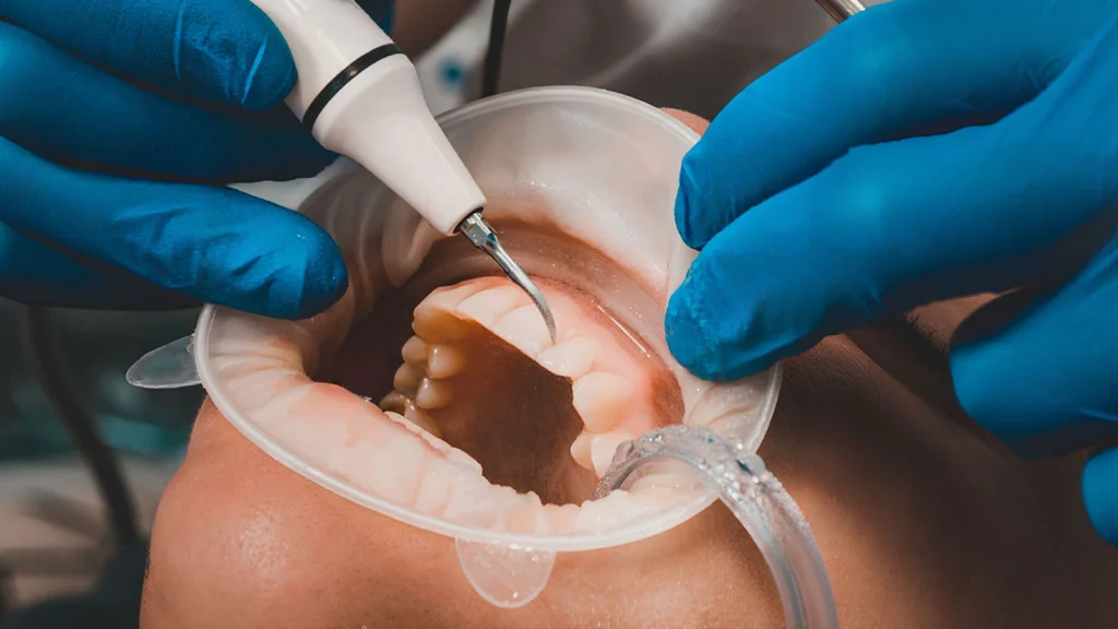 Dental Hygienist Meridian