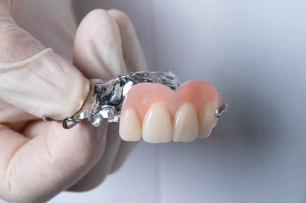 Partial Dentures for Back Teeth