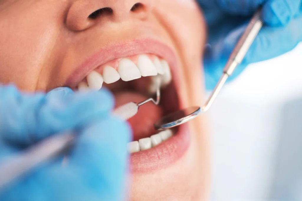 deep cleaning teeth