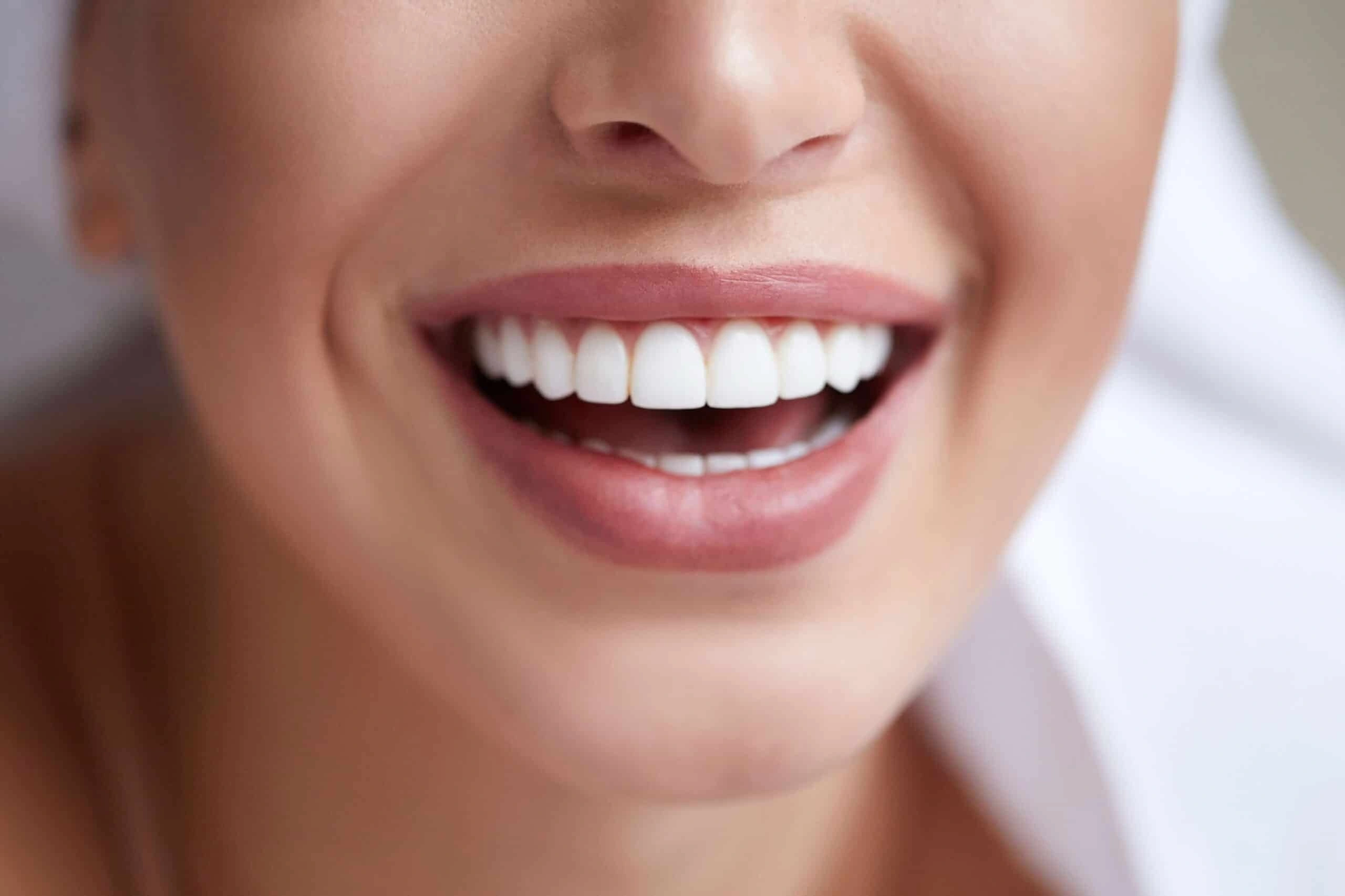Professional Teeth Whitening Meridian